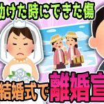 【2ch修羅場】親友の結婚式で新郎に親友を救った際にできた顔の傷をいじられたら親友が大激怒！離婚騒動へ【ゆっくり解説】