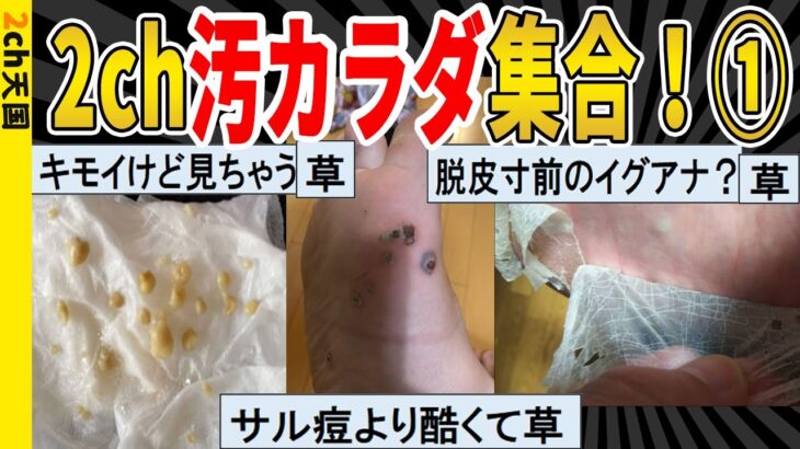 【2ch面白いスレ】2ｃｈ汚カラダ集合！①大量匂い玉ネキ、足イボニキ、アンチエイジングカワハギニキｗｗｗｗｗ　聞き流し/2ch天国