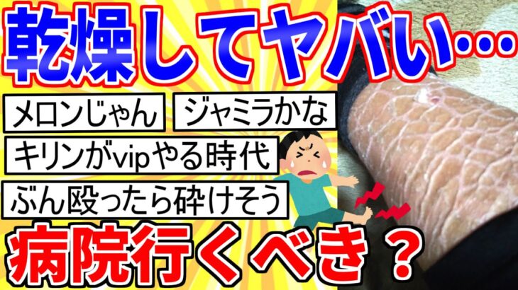 【2ch面白いスレ】ワイの皮膚、冬になると乾燥肌でヤバい…【ゆっくり解説】