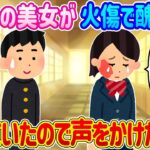 【2ch馴れ初め】学校1の美女が顔に火傷して醜い姿に…ある日泣いていたので声をかけた結果…【ゆっくり】