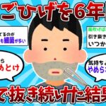 【2ch有益スレ】あごひげを６年間自分で抜き続けた結果ｗｗｗ【ゆっくり解説】