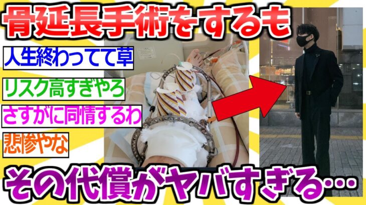 【2ch面白いスレ】低身長さん、人生賭けて骨延長手術するもその後遺症がヤバすぎる…【ゆっくり解説 2ちゃんねる まとめ 5ch】