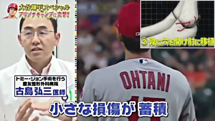 プロ野球　大谷翔平の右ヒジを救え！